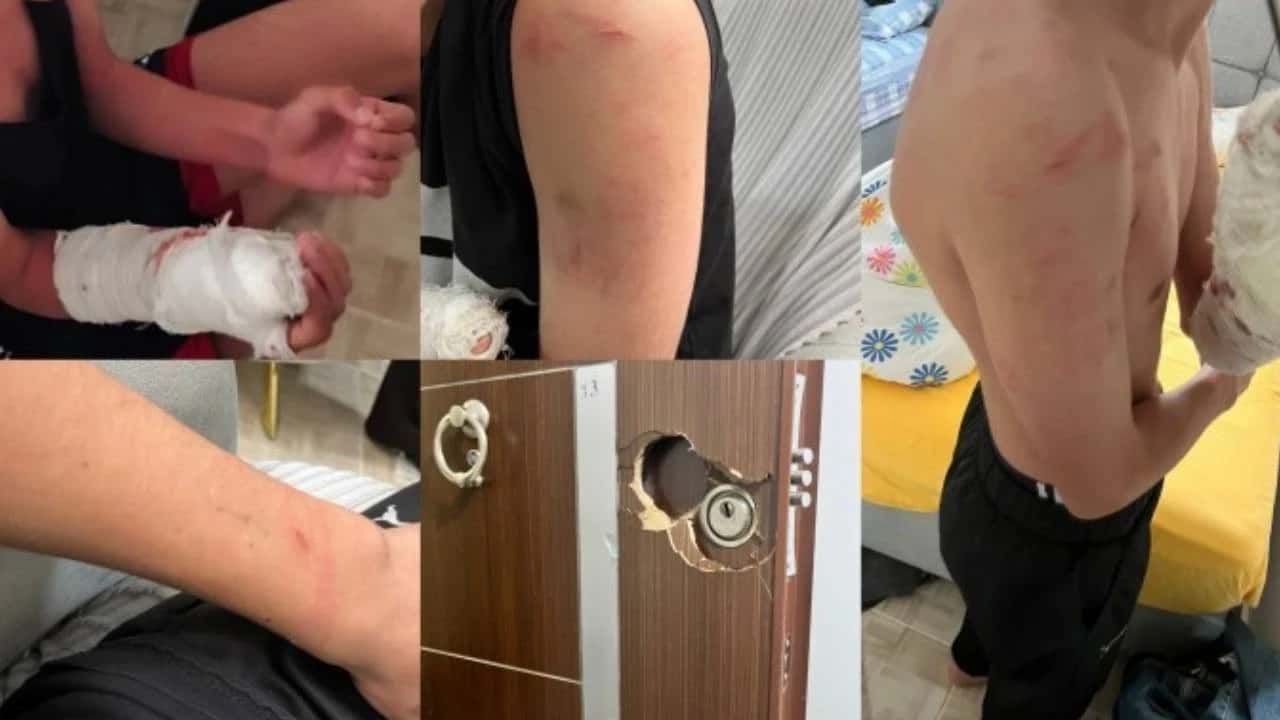 Bingöl’de Polis işkence yapıp 'pardon' dedi