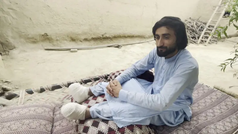 BBC Afgan Forensic ile konuşan 12 göçmenden biri, 24 yaşındaki Navid Ullah, sakallı, açık mavi şalvar giymiş. Alt bacakları ampute.
